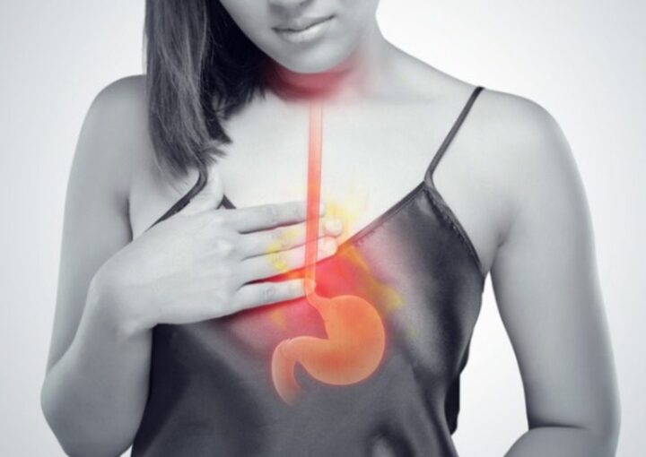 γαστοοισοφαγική παλινδρόμηση ιατρικά Κατσούλας katsoulas.eu