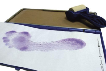 Ποδογράφος με αποτύπωση πέλματος και πίεσης σε χαρτί με μελάνι